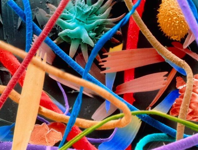 Amazing Scanning Electron Microscope Pictures