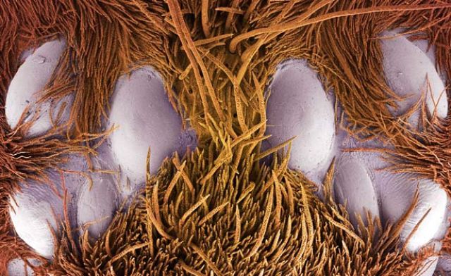 Amazing Scanning Electron Microscope Pictures