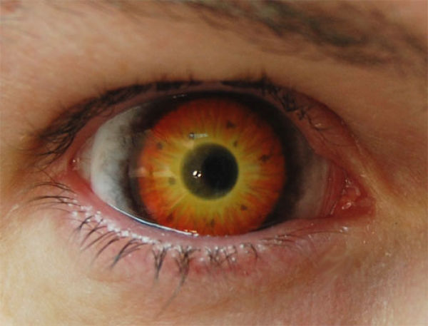 Eerie Eyeball Covers