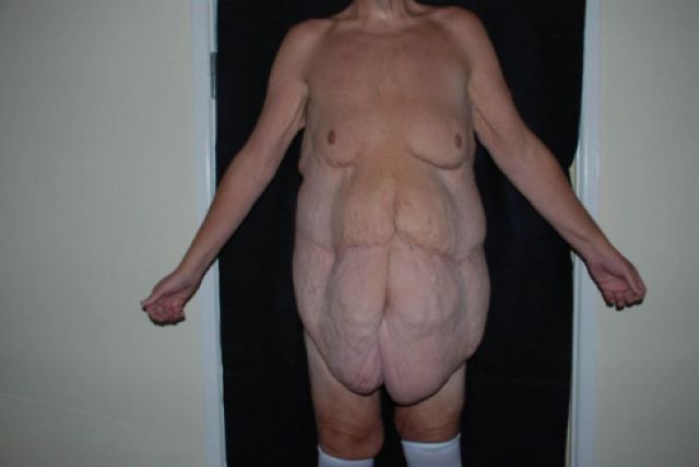 Content Image