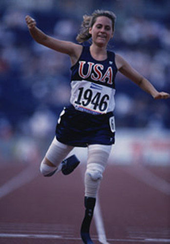 Woman Overcomes Huge Adversity