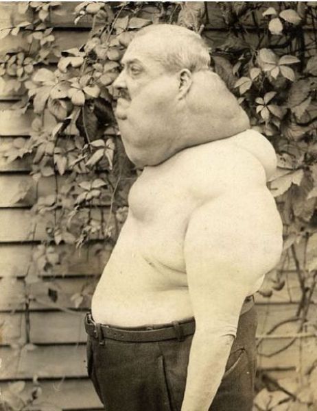 Content Image