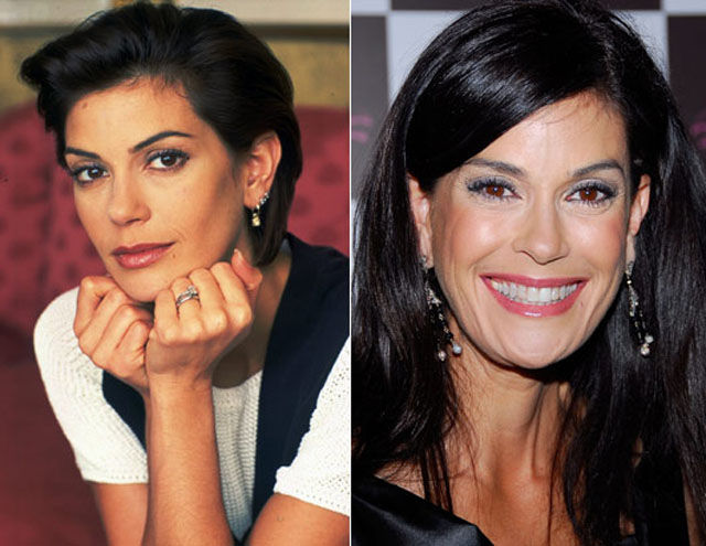 Celebrity Plastic Surgery Before & After