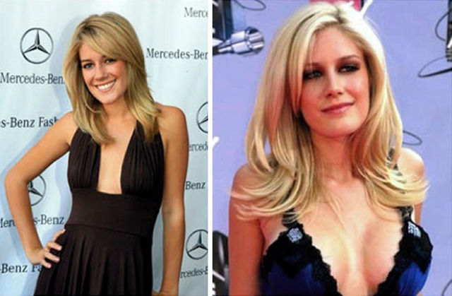 Celebs with the Worst Fake Breasts: Before and After
