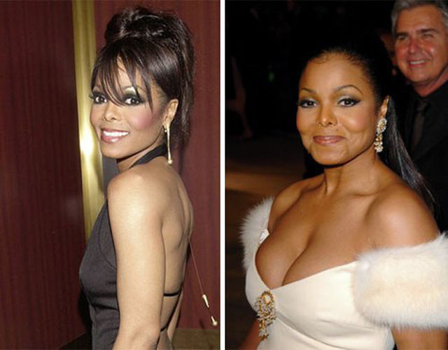 Celebs with the Worst Fake Breasts: Before and After