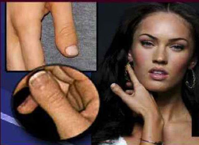 Celebs Have Imperfections Too!