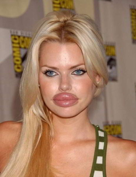 Sometimes Beauty Treatments Just Make You Ugly