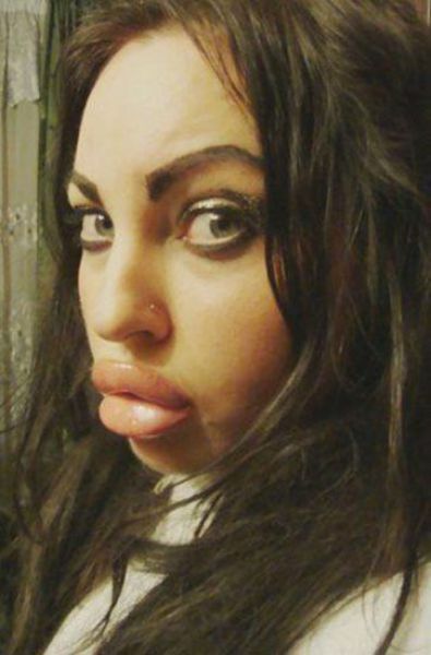 Sometimes Beauty Treatments Just Make You Ugly