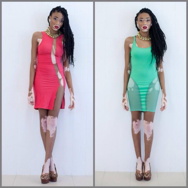 The Top Model without Stereotypical Good Looks