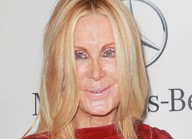 Plastic Surgery Fails That Are Just Wrong