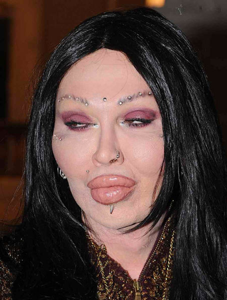 Plastic Surgery Fails That Are Just Wrong