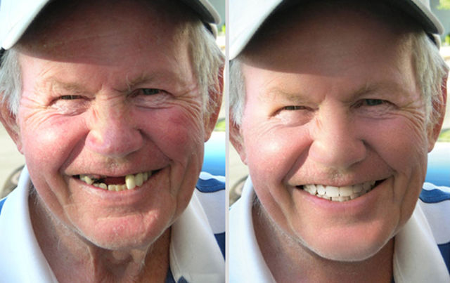 Examples Where Photoshop Makes Pics Better