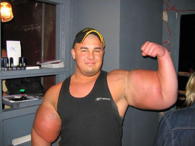 Extreme Bodybuilders Who Have Taken It a Bit Too Far