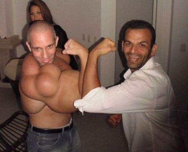 Extreme Bodybuilders Who Have Taken It a Bit Too Far