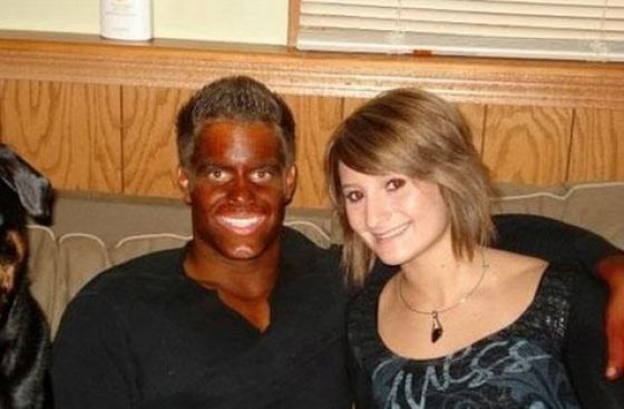 Tans Gone Horribly Wrong