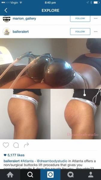 People Who Shamelessly Break Social Boundaries In Social Media And Just Don’t Care