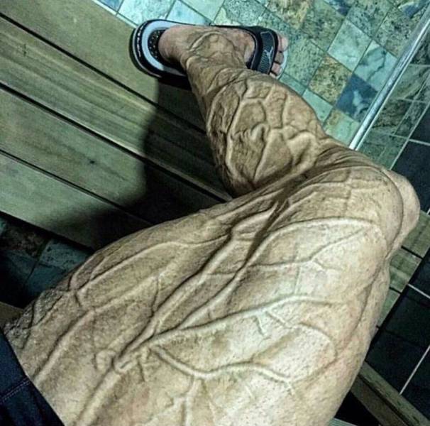 Content Image